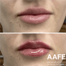Comfortox Lips